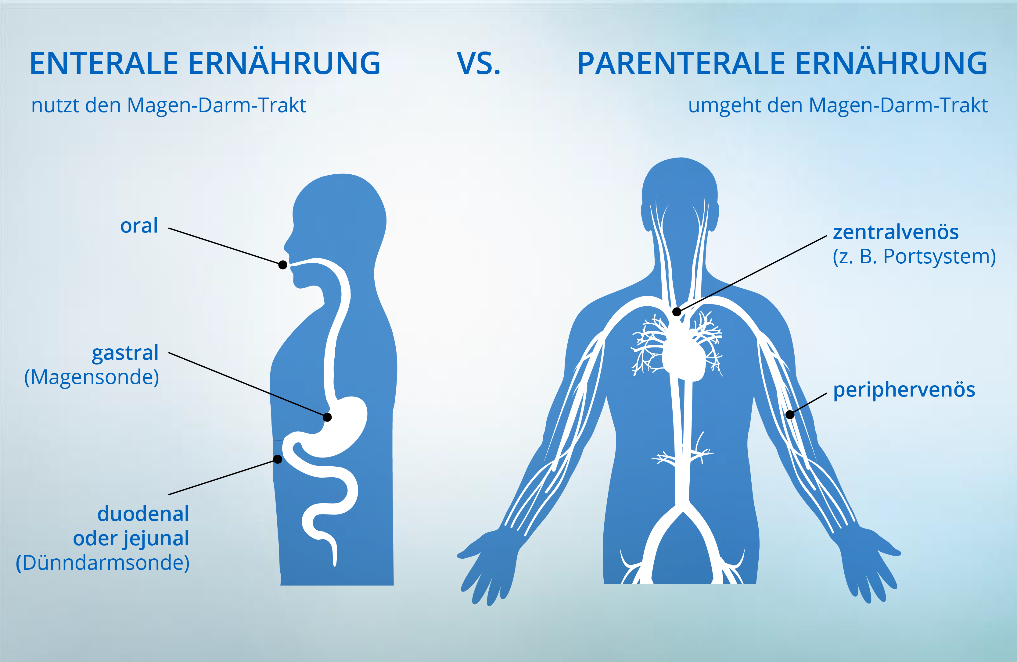 Enterale vs Parenterale Ernährung